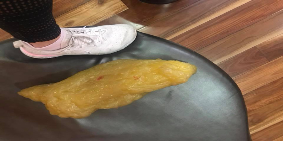 What Does Four Pounds of Fat Look Like?