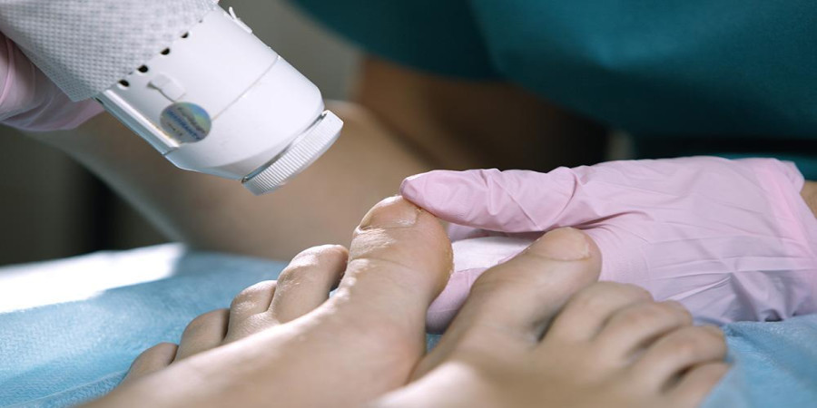 Laser Treatment for Toenail Fungus: Understanding the Pros and Cons