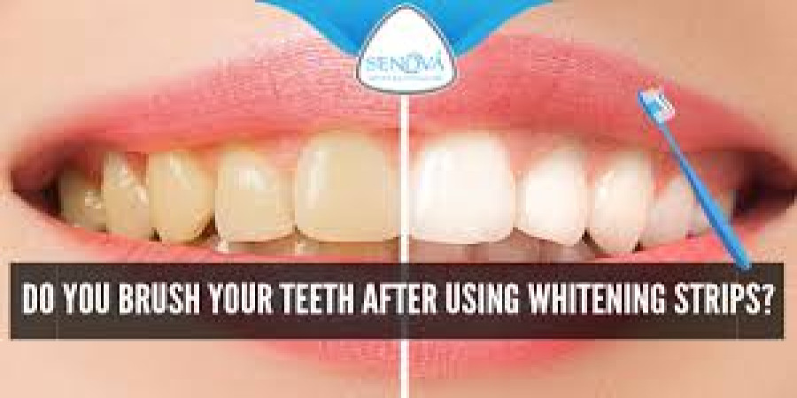 Brushing After Whitening Strips: Timing is Key for a Brighter Smile